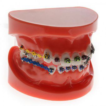 Модель зубов ортодонтия №2